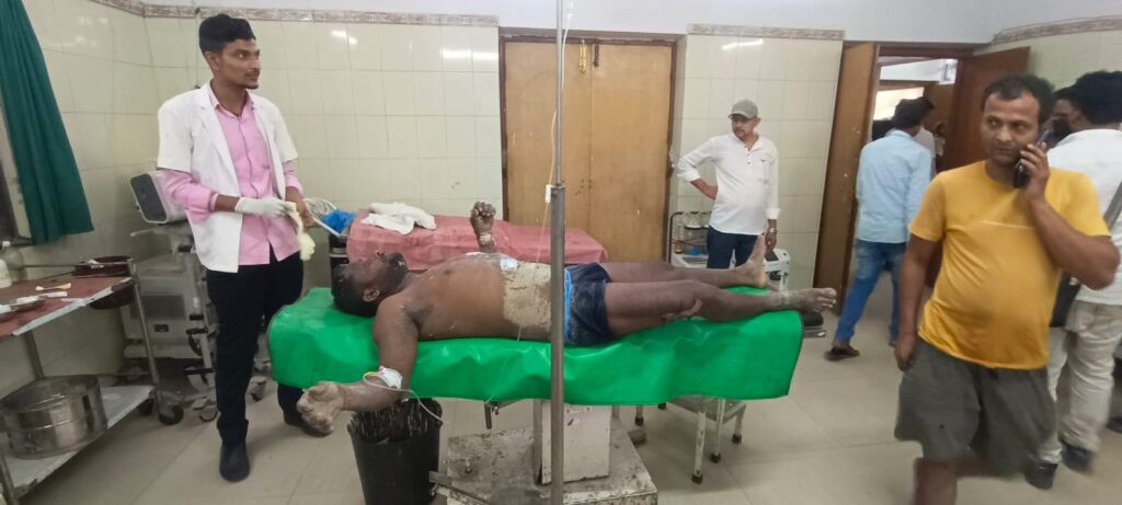 आंधी में फीडर लाइन टच होने से लाइनमैन को लगा करंट, सदर अस्पताल में भर्ती।