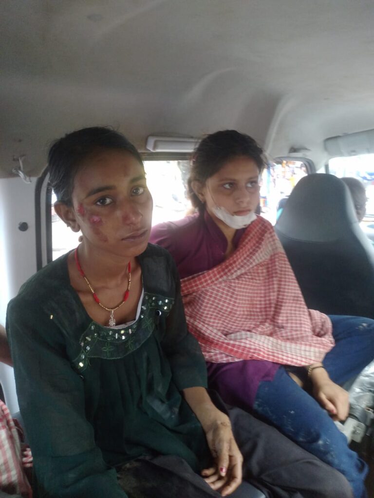 तेज बारिश में गिरी सीढ़ी, पांच लोग घायल, दो गंभीर